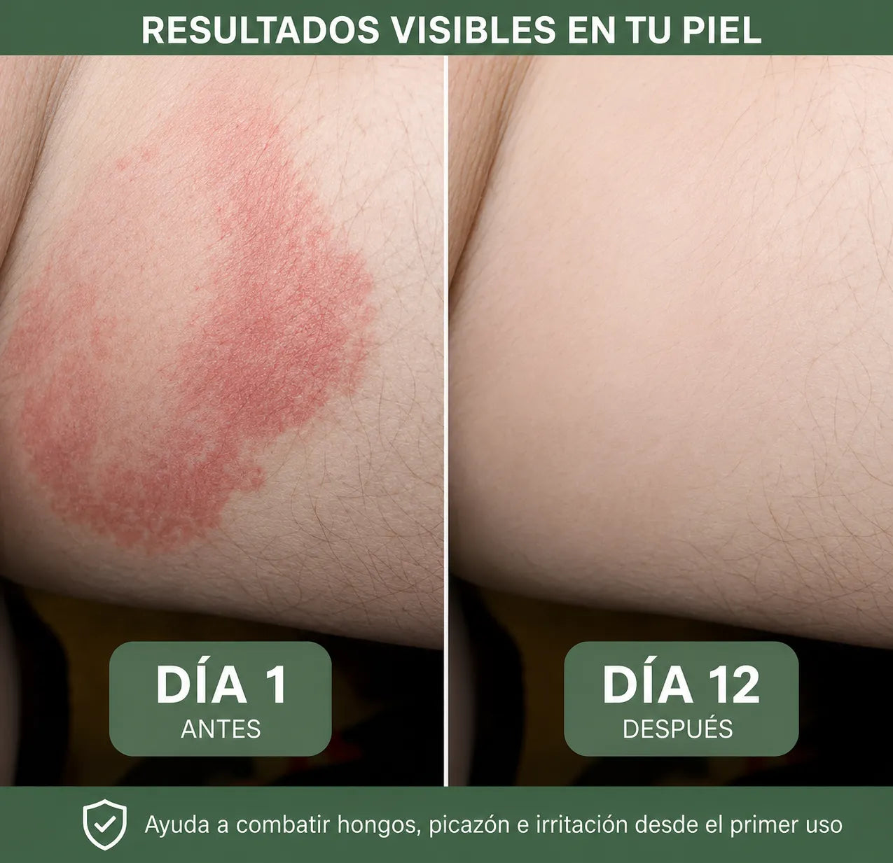 🍃Veloma Jabón Antimicótico de Aceite de Árbol de TE. 2X1 🔥🧼