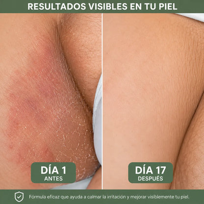 🍃Veloma Jabón Antimicótico de Aceite de Árbol de TE. 2X1 🔥🧼
